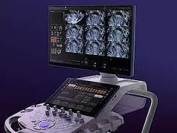 Voluson signature 18 reconditionné