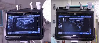 echographe d occasion Venue GO reconditionné