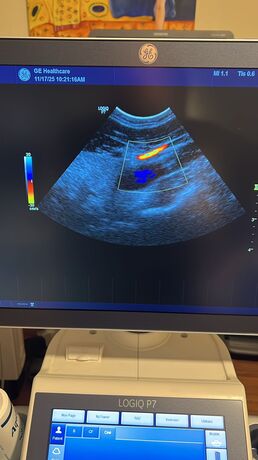 logiq P7 veterinaire reconditionné