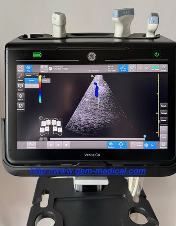 echographe d occasion Venue GO reconditionné 3000€ ht