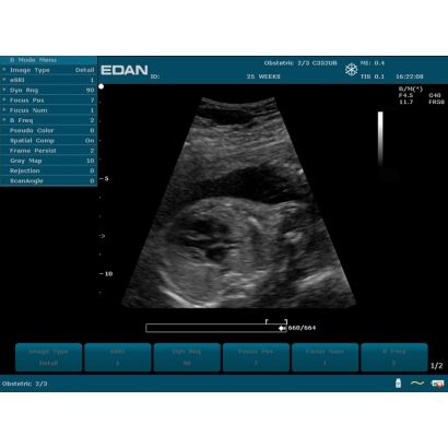 EDAN U50 sur chariot double sonde récent 3800 ht