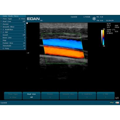 EDAN U50 sur chariot double sonde récent 3800 ht