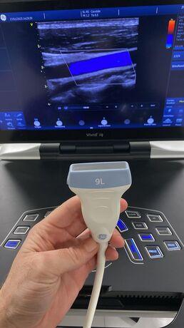 echographe cardiaque Vivid S6 reconditionné 8000€ ht