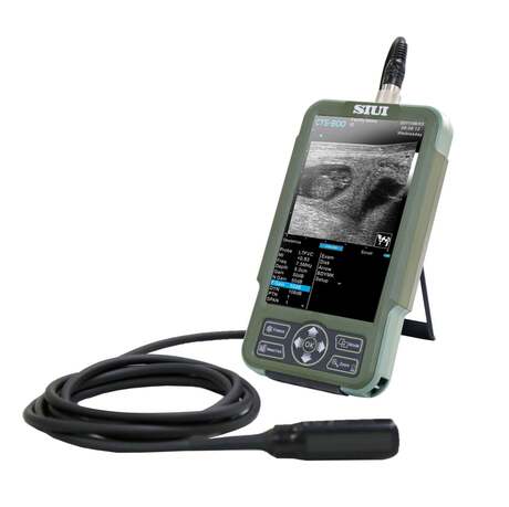 Échographe portable SIUI CTS-800 – Sonde rectale linéaire 3500€ HT