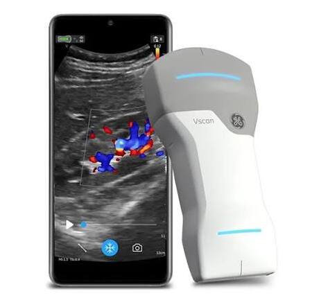 Vscan Air CL NEUF prix exeptionnel 3200€ HT