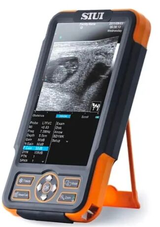 Échographe portable SIUI CTS-800 – Sonde rectale linéaire 3500€ HT