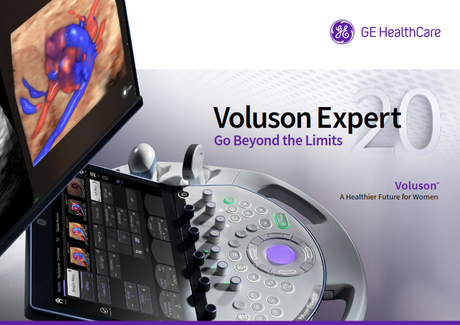 Voluson expert 20 reconditionné constructeur