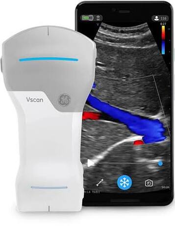 Vscan Air CL NEUF prix exeptionnel 3200€ HT
